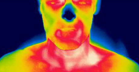 兩名BAT陽(yáng)性受試者和(B)一名BAT陰性受試者在120分鐘冷卻前后的代表性PET-CT和紅外熱成像